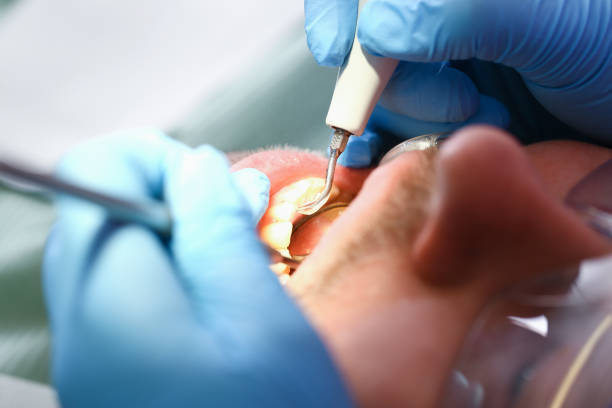 Best Urgent Tooth Repair  in Macungie, PA