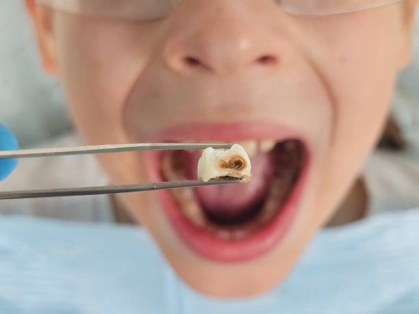 Best Knocked-Out Tooth Emergency  in Macungie, PA